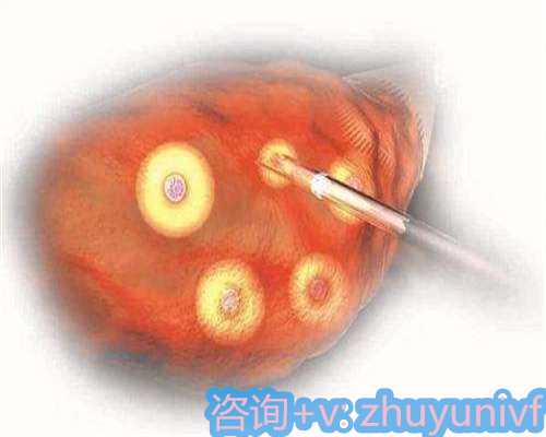 面对20天宝宝睡眠困扰，如何让宝宝安心入睡