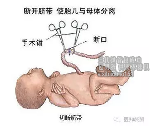 广州专业代怀收费，试管婴儿失败要过多久才能做第二次？专家劝你这样做
